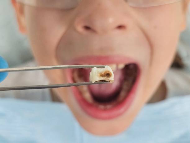 Best Tooth Pain Emergency Relief  in Dormont, PA